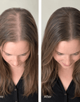 MetaGen kit Metagen Metabolic Scalp + Hair Growth Support System